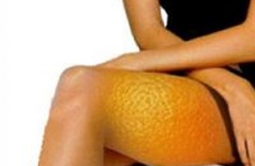 Мифы о целлюлите