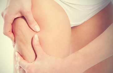 Статья: 10 злейших врагов целлюлита