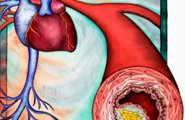 Статья: Как предотвратить накопление шлаков в организме